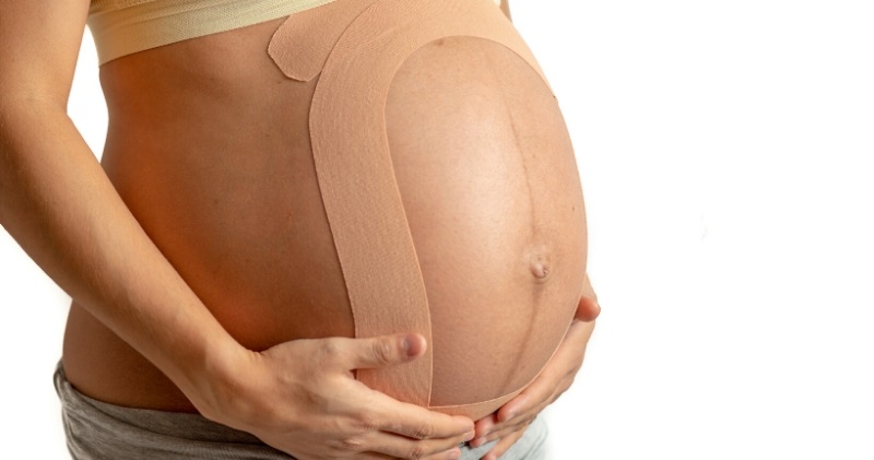 Kinesiotape on a pregnant belly to provide support and alleviate pain. 