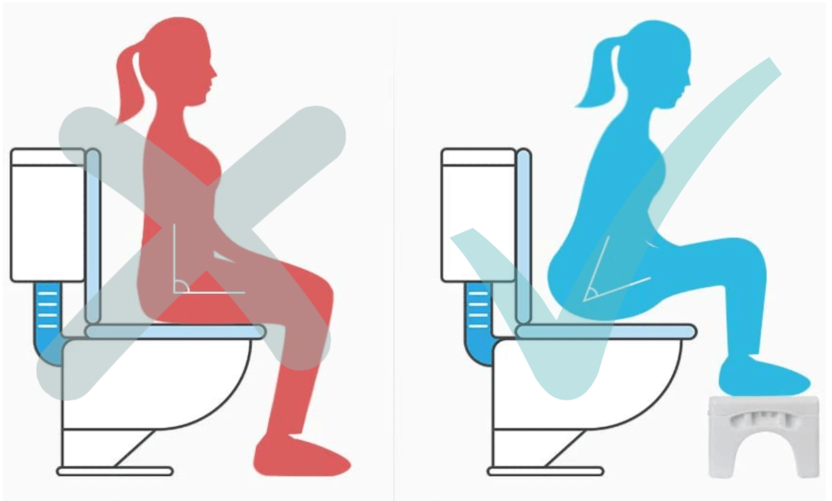 How to squat using a foot stool to avoid or treat constipation
