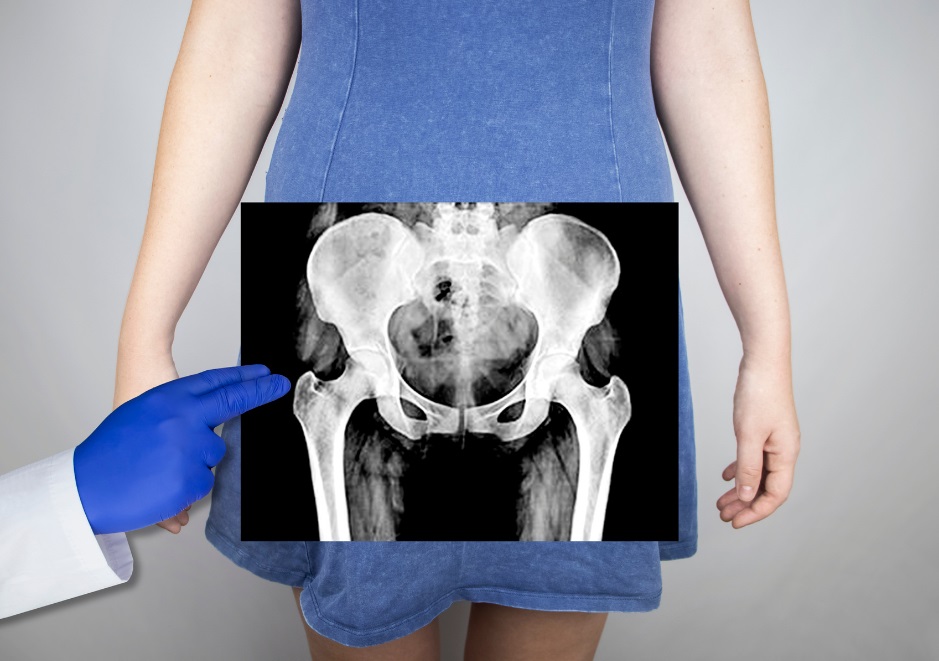 Treatment for pelvic floor dysfunction using INDIBA Activ at PelviCare Women's Health Physiotherapy