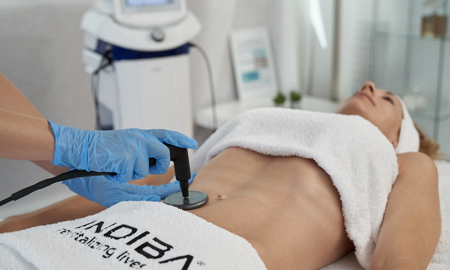 Indiba Activ treatment applied to a young woman's midriff to treat pelvic floor dysfunction. 
